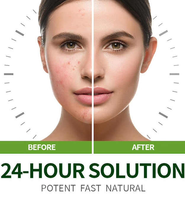Tea Tree Moisturizing Cream Repair