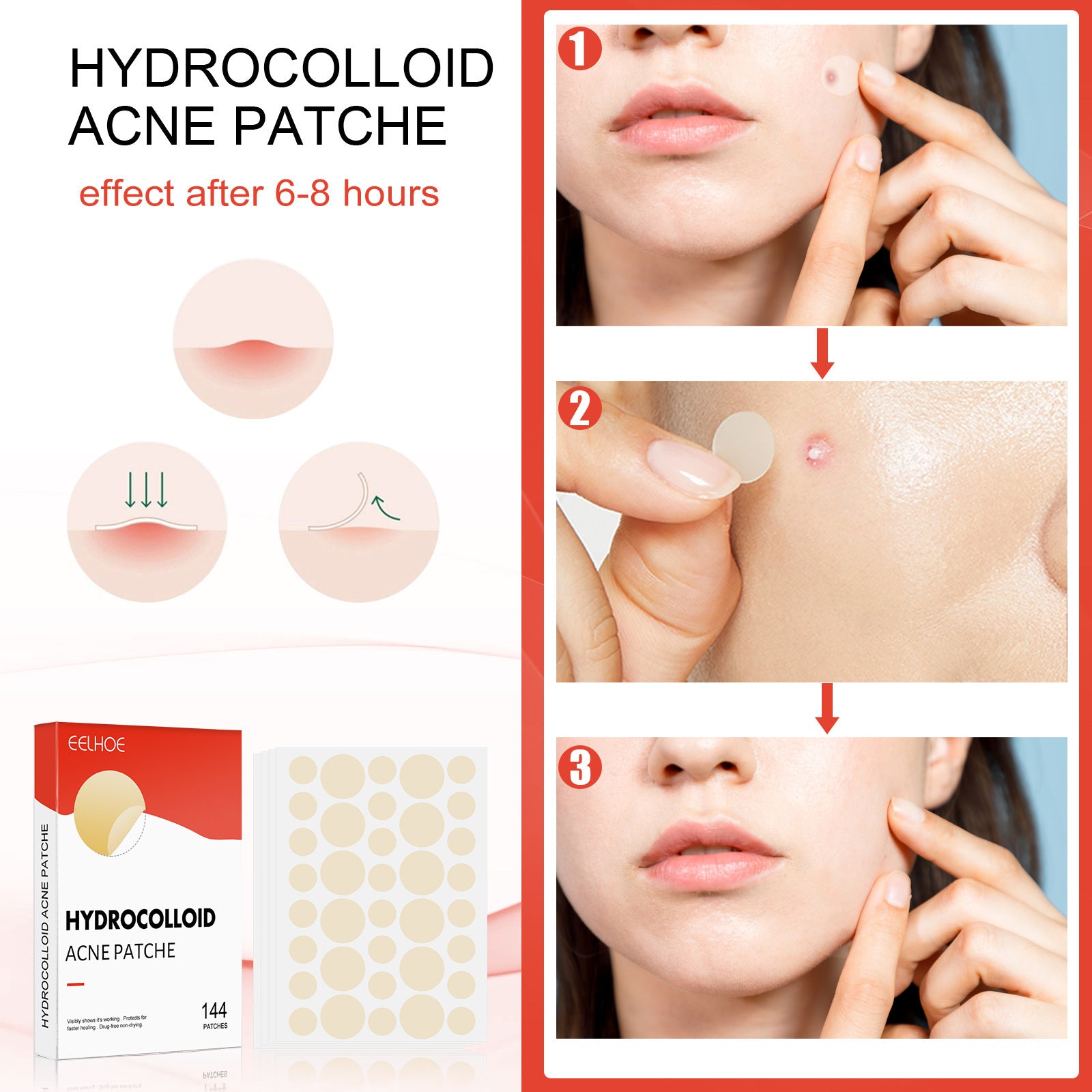 Eelhoe Hydrocolloid Acne Patch Invisible Makeup Closed