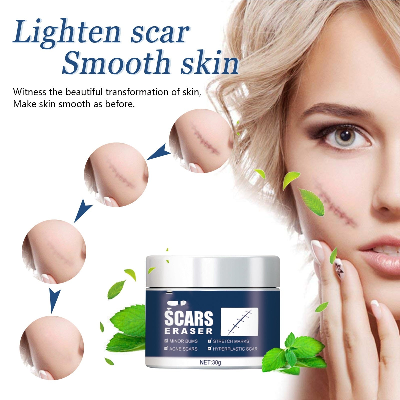 Dilute Scar Cream Cold Compress Burn And Scald Marks Dilute Surgical Scar Repair