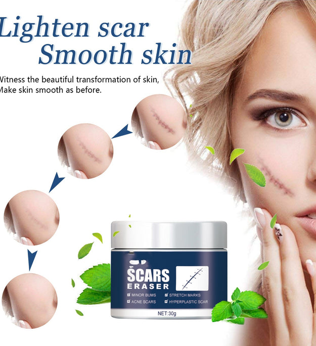 Dilute Scar Cream Cold Compress Burn And Scald Marks Dilute Surgical Scar Repair