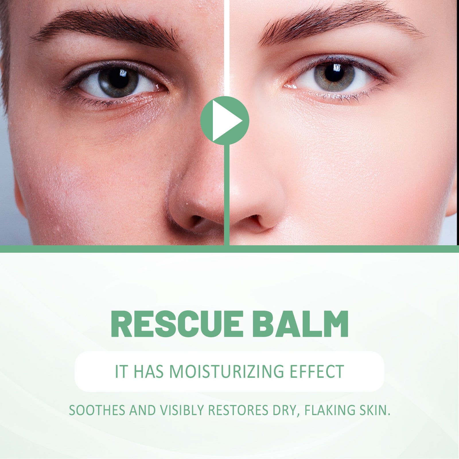 Blemish Gel Modifies Spot Acne Print Cover