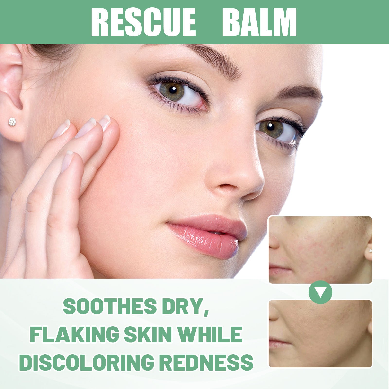Blemish Gel Modifies Spot Acne Print Cover