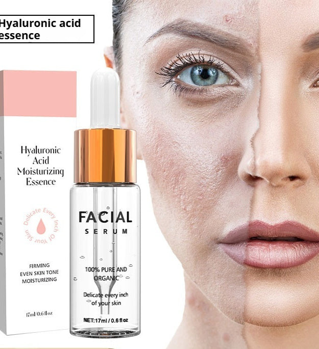 Hyaluronic Acid Toner And Lotion Moisturizing And Brightening Skin Tone