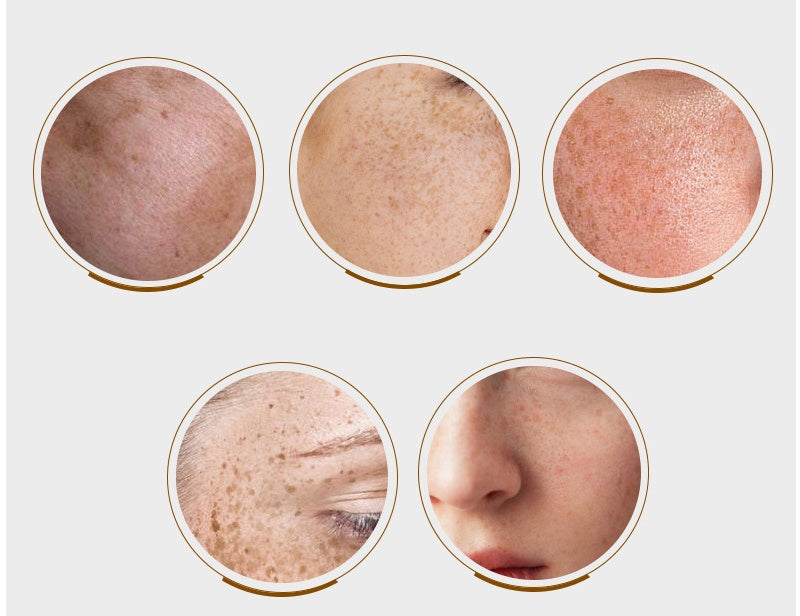 Whitening Cream Spot Spot Pen Spot Spot Lotion