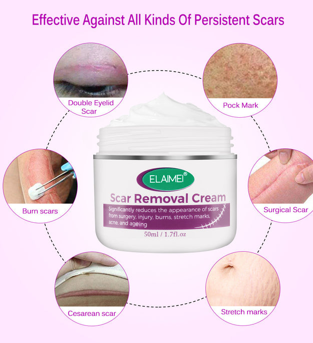 Skin Rebound Scarless Cream Scar Removal Cream Face Cream For Face Acne Scar Stretch Marks Skin Repair Face Cream