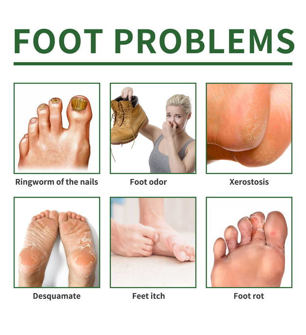 Nail Repair Foot Mask