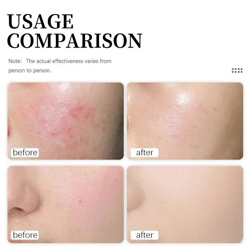 Protect And Repair Skin Moisturizing Relieving Soothing Cream