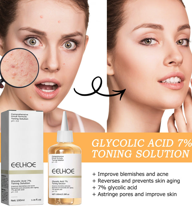 Glycolic Acid 7 Lotion Acne Removing Closed Mouth
