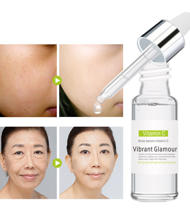 Vitamin C Acne