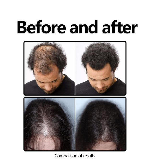 Herbal Hair Care Solution Anti-hair Loss And Strong