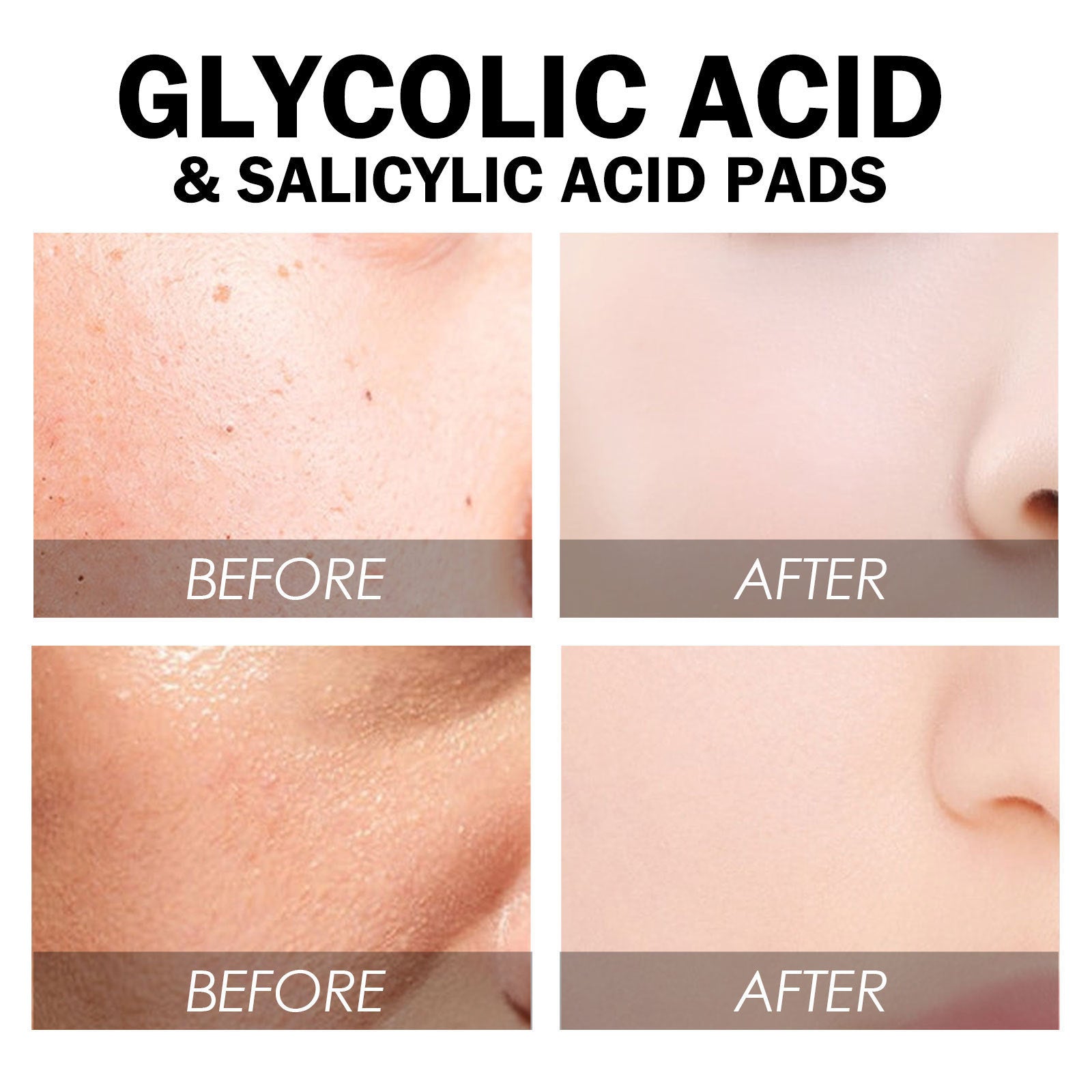 Facial Glycolic Acid Gasket Moisturizing