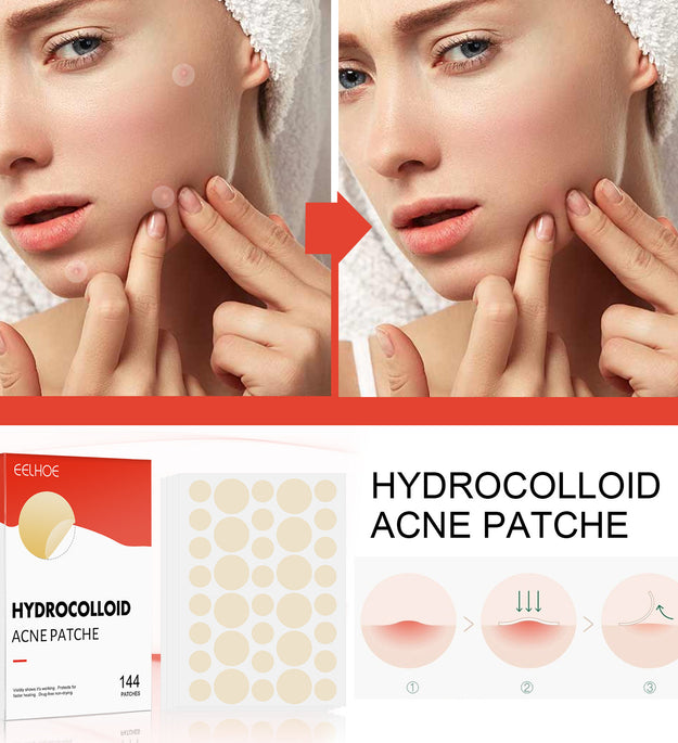 Eelhoe Hydrocolloid Acne Patch Invisible Makeup Closed