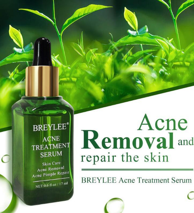 Acne Treatment Serum Facial Repair Oil