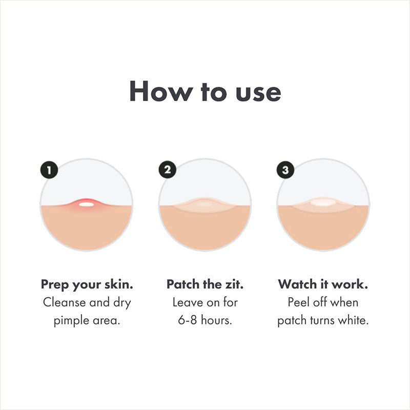Chin Acne Day And Night Use Repair Acne Patch
