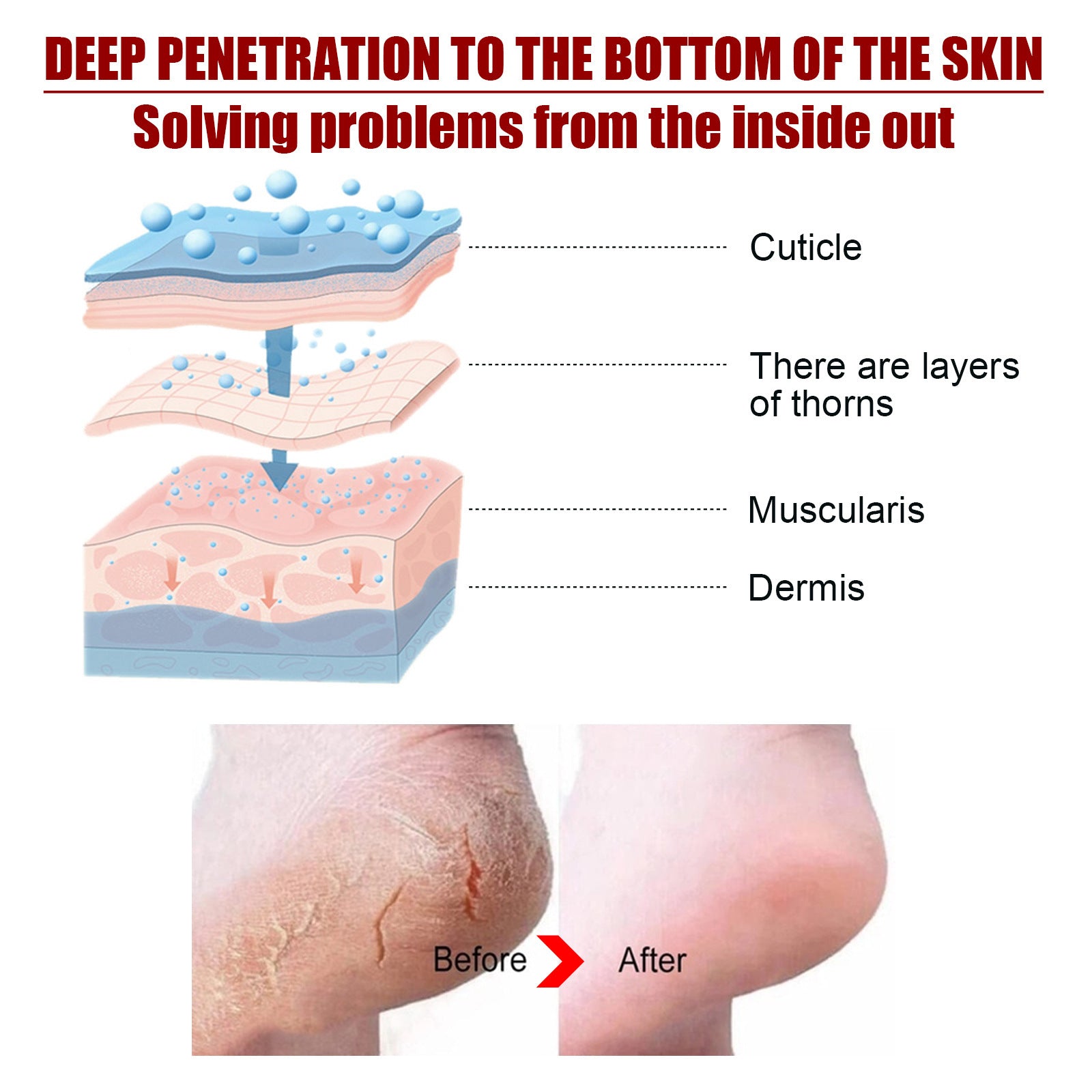 Exfoliating Foot Mask Fruit Acid Nourishing Repair Hydrating Moisturizing Nourishing
