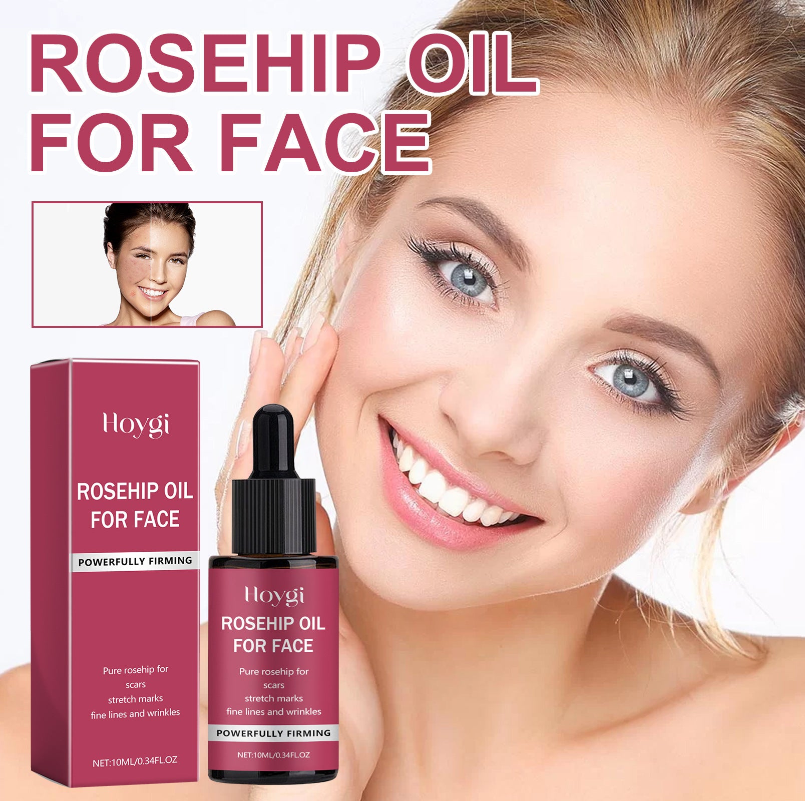 Rosehip Treatment Oil Gently Moisturizes Skin