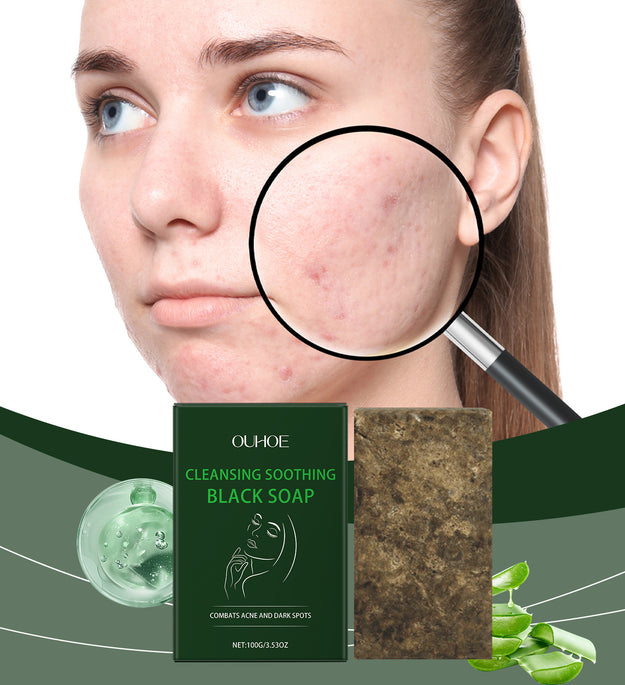 Gentle Cleansing Facial Moisturizing Skin Care Elastic Moisturizing Delicate Cleansing Soap