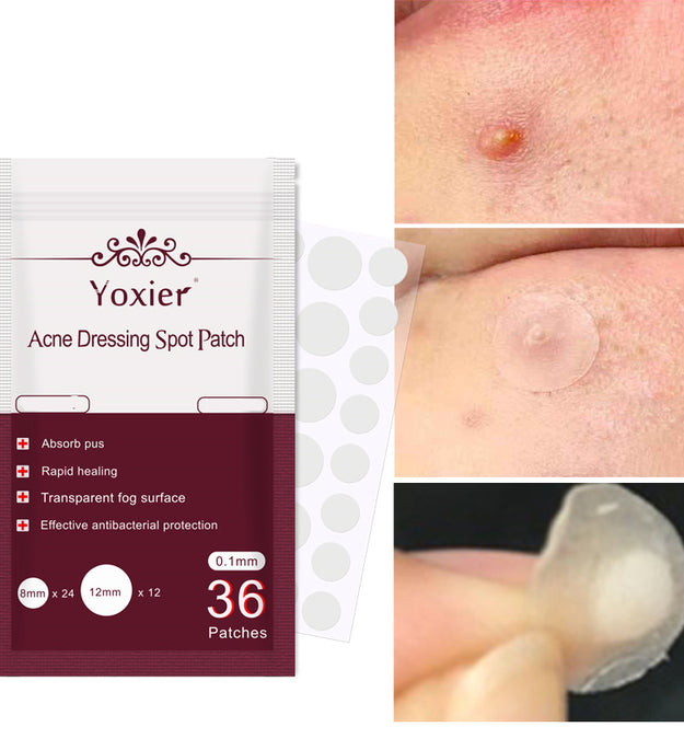 Skin Care Tools Acne Dressing Spot Patch Blemish Treatment Invisible Acne Stickers Pimple Remover Set Face Cream