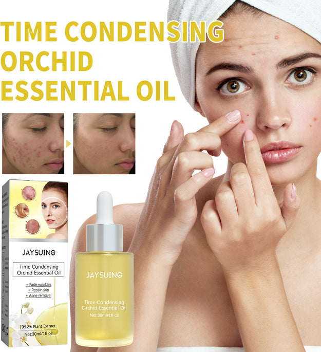 Orchid Acne Treatment Oil Cleansing And Brightening