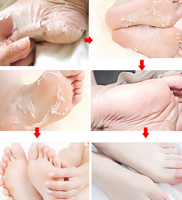 Exfoliating Foot Mask Fruit Acid Nourishing Repair Hydrating Moisturizing Nourishing