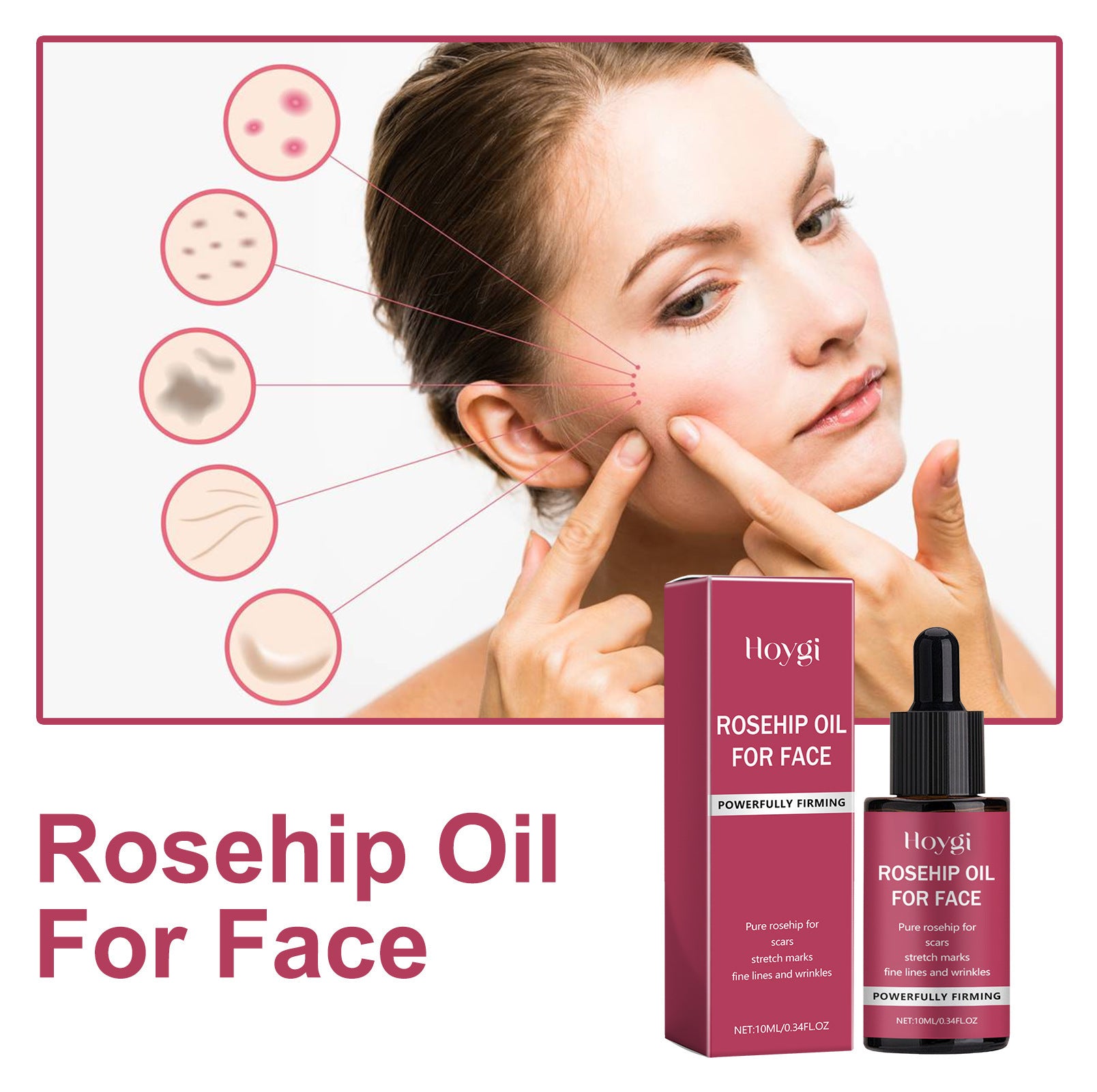Rosehip Treatment Oil Gently Moisturizes Skin