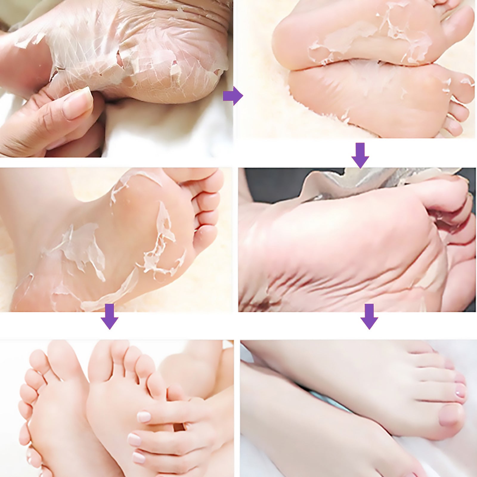 Foot Skin Chapped Exfoliating Exfoliating Exfoliating Skin Moisturizing And Nourishing Foot Mask