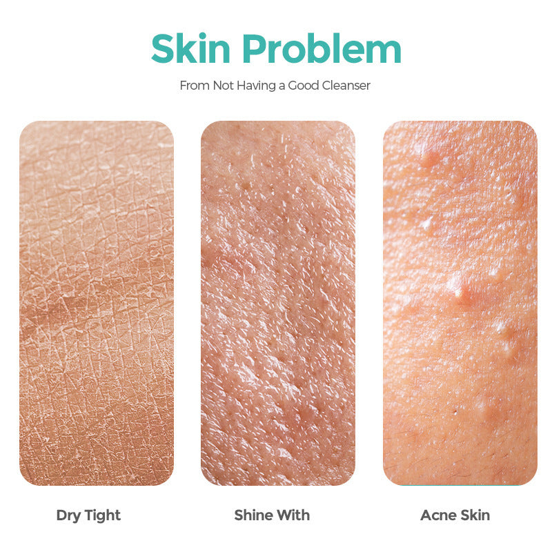 Salicylate Acne Cleanser Hydrating And Cleaning