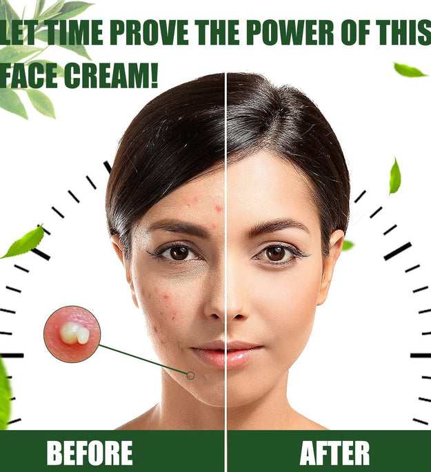 Cream Skin Repair Clean Acne Care