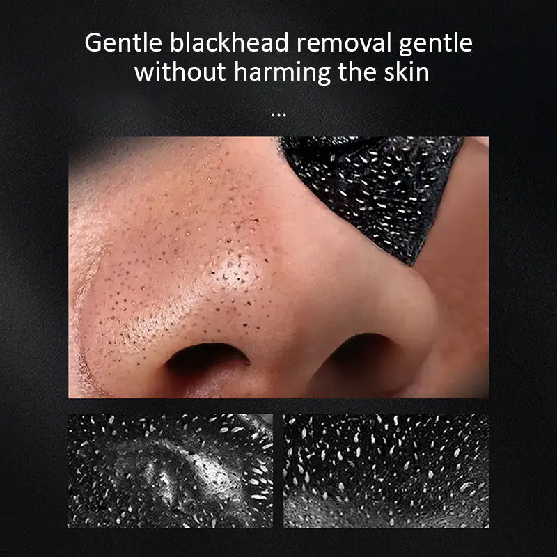 Pore Acne Cleanser Clay Mask Shrink Pores