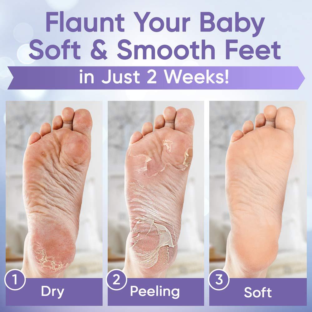 Lavender Foot Mask Exfoliating Moisturizing Repair