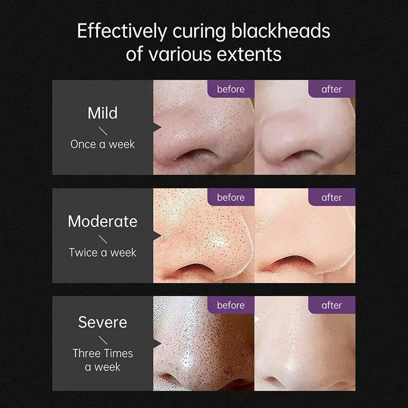 Pore Acne Cleanser Clay Mask Shrink Pores