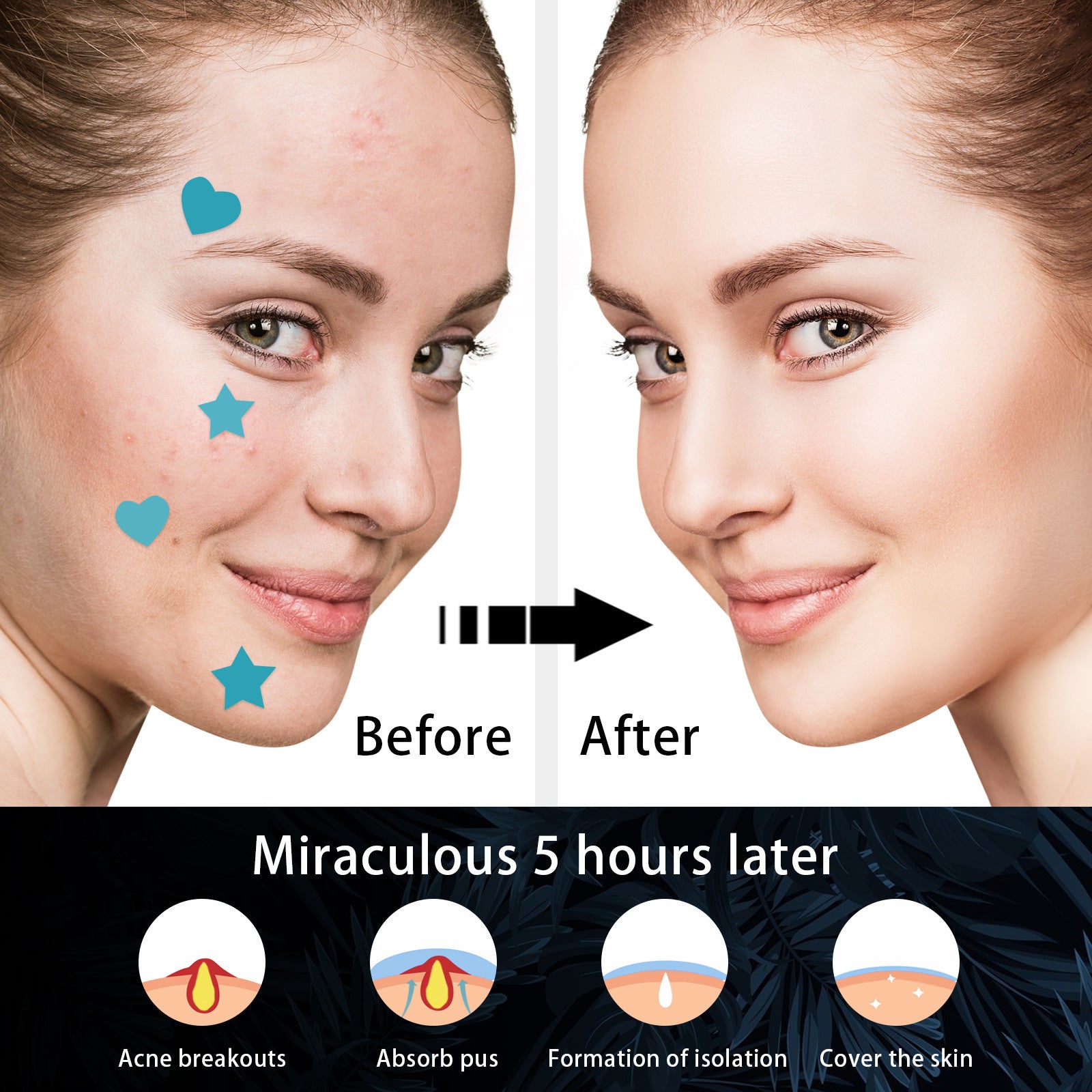 Hydrocolloid Acne Patch Cleaning Invisible And Breathable