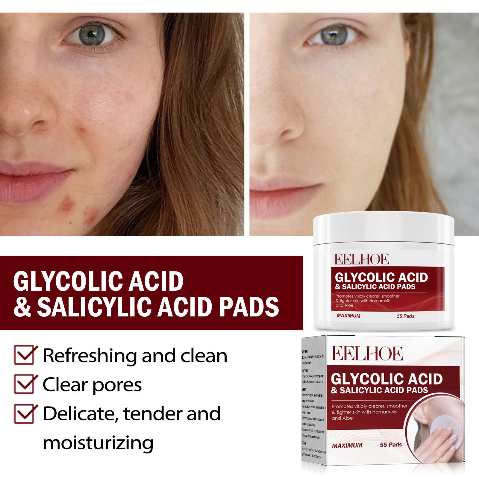 Facial Glycolic Acid Gasket Moisturizing