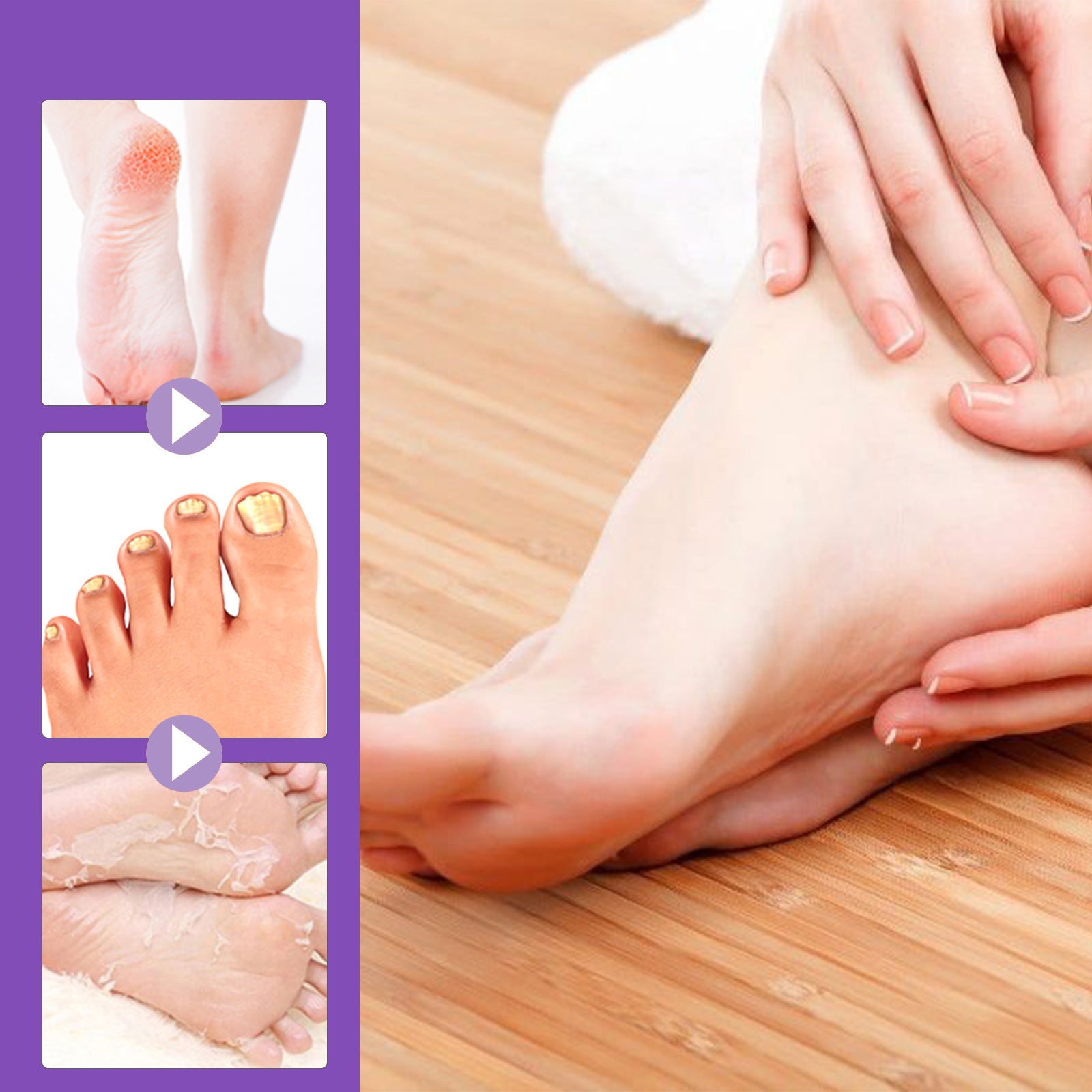 Foot Skin Chapped Exfoliating Exfoliating Exfoliating Skin Moisturizing And Nourishing Foot Mask
