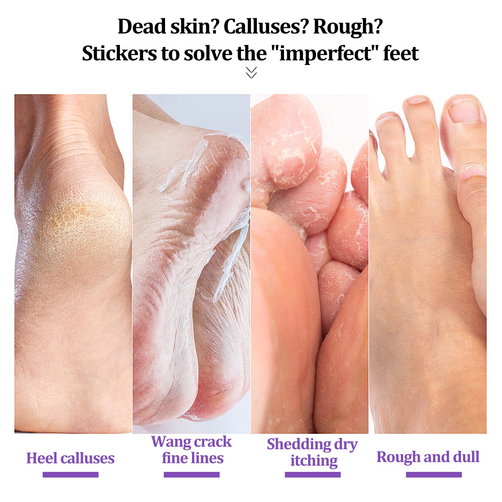 Foot Skin Chapped Exfoliating Exfoliating Exfoliating Skin Moisturizing And Nourishing Foot Mask