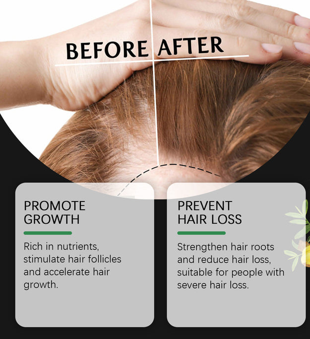 Fertility Batana Hair Oil Prevents Loss Of Activated Hair Follicles