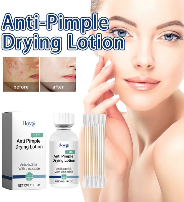 Fade Acne Cream Facial Cleaning And Repair Smallpox Diluting