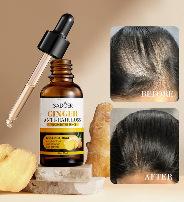 Ginger Care Oil Hair Loss Growth