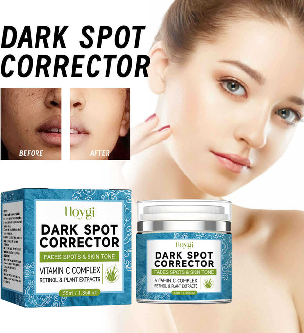 Fade Dark Spots Repair Skin Dull Whitening Skin Lightening Cream