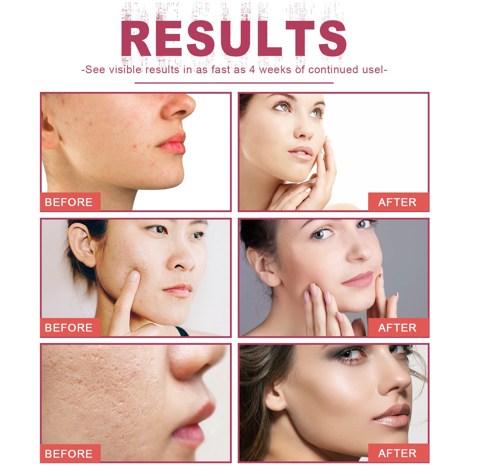 Rosehip Treatment Oil Gently Moisturizes Skin