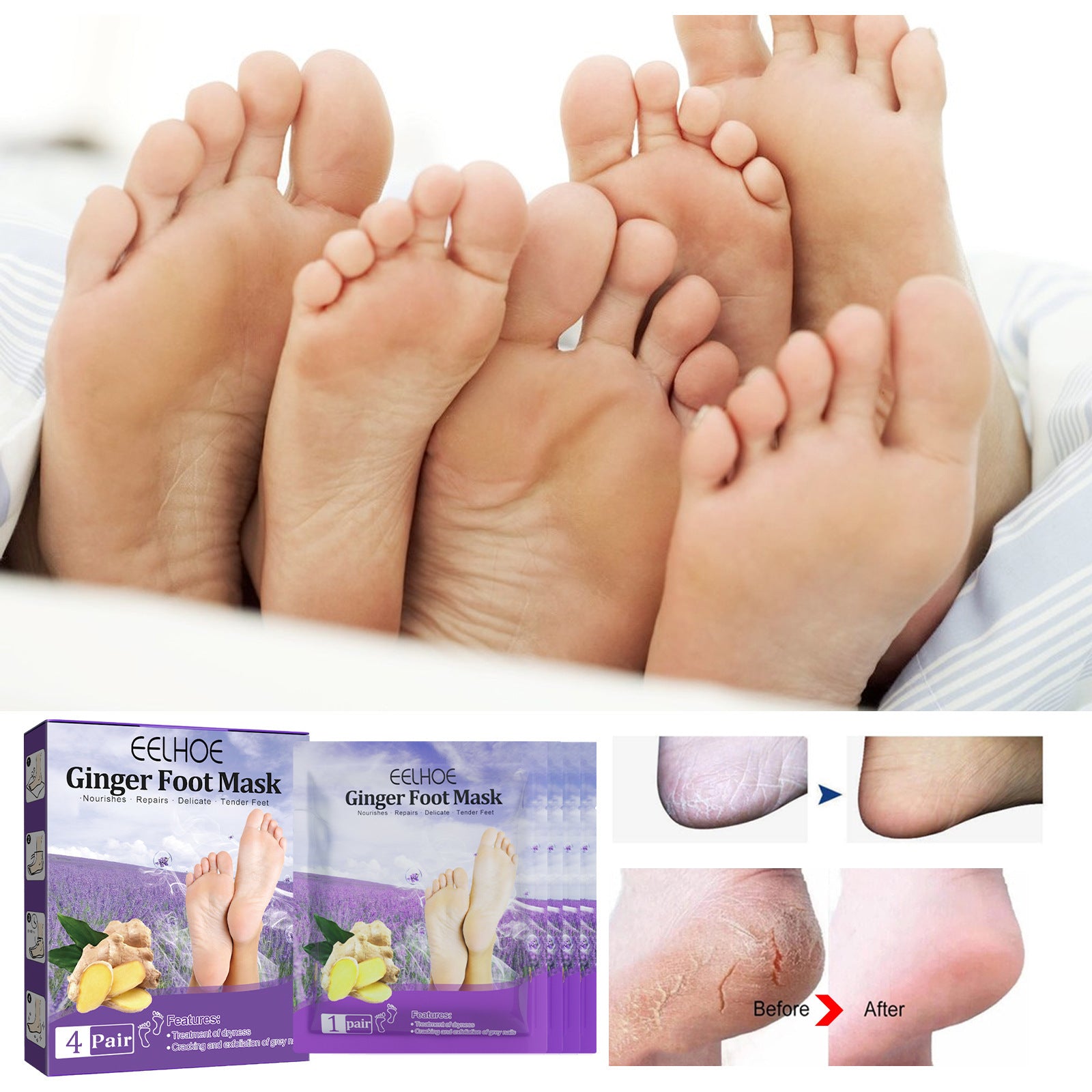 Foot Skin Chapped Exfoliating Exfoliating Exfoliating Skin Moisturizing And Nourishing Foot Mask