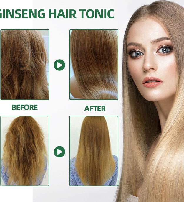 Ginseng Hair Growth Liquid Spray To Prevent Hair Loss