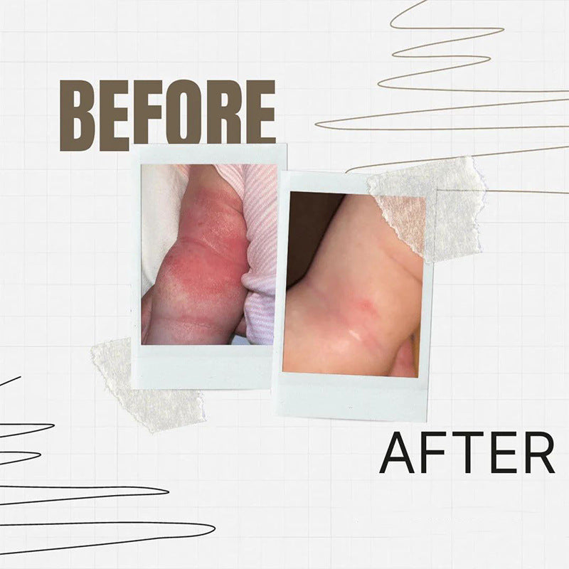 Protect And Repair Skin Moisturizing Relieving Soothing Cream