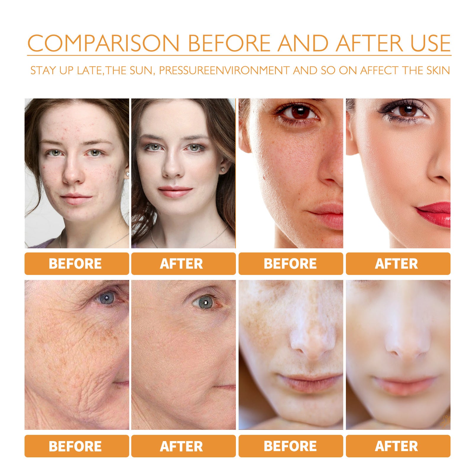 Turmeric Facial Smallpox Diluting Refreshing Oil Control