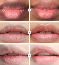Before and after images showing lips improved from dry and cracked to smooth and hydrated using lip treatment