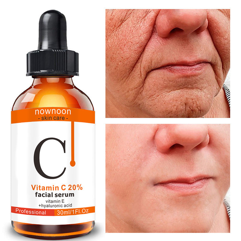Hyaluronic acid vitamin C serum bottle with before and after images showing improved facial skin texture