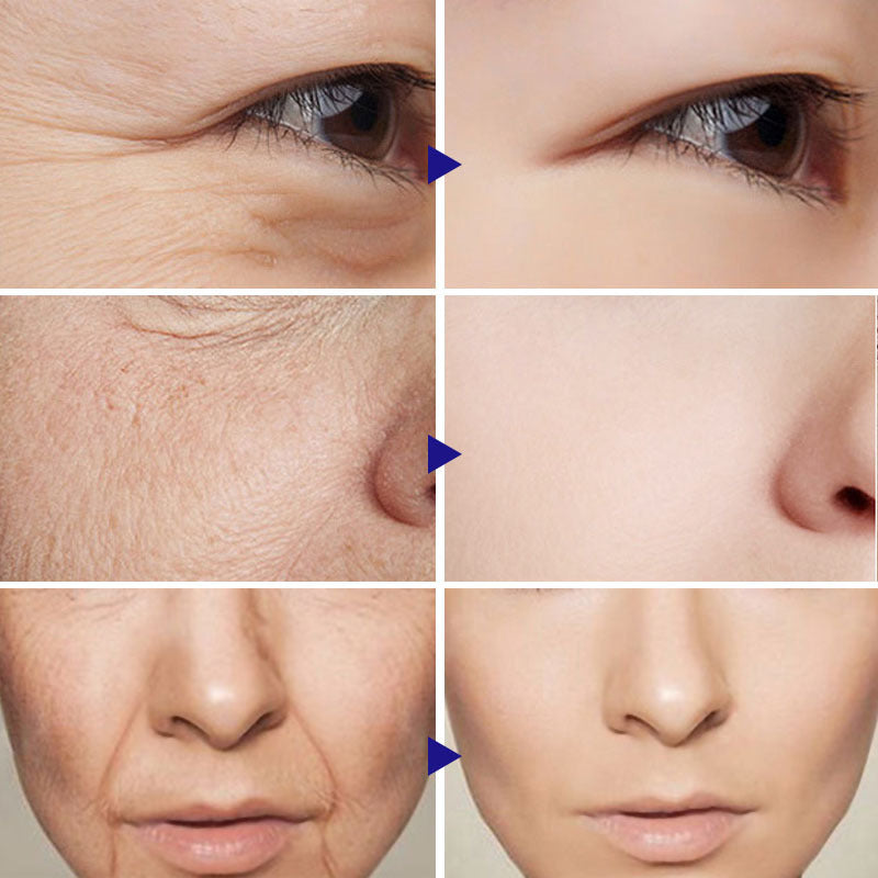 Before and after photos showing skin improvement using the best facial serum for brightening skin