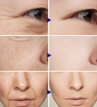 Before and after photos showing skin improvement using the best facial serum for brightening skin